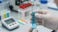 water quality test results