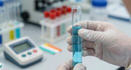 water quality test results